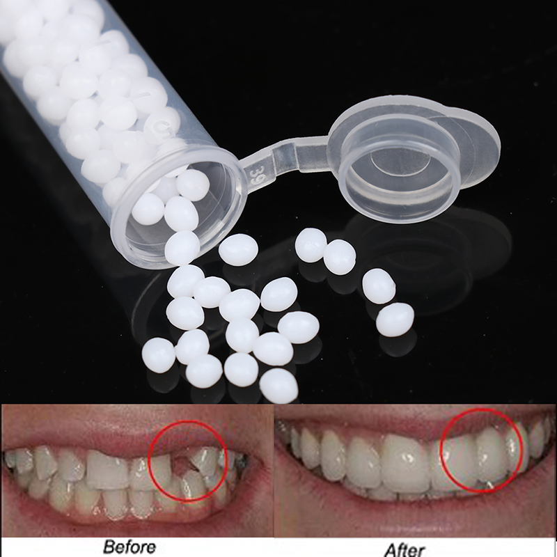 【K】1 กล่อง ชุดซ่อมฟันชั่วคราว  - Teeth Whitening Kit บทวิจารณ์และราคา