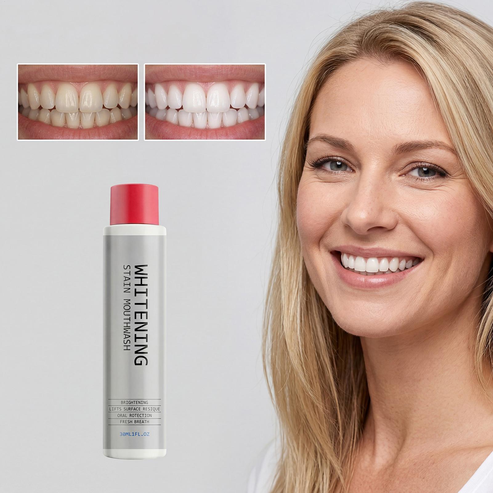 น้ำยาบ้วนปากขจัดคราบ 30 มล. ช่ - Teeth Whitening Mouthwash บทวิจารณ์และราคา